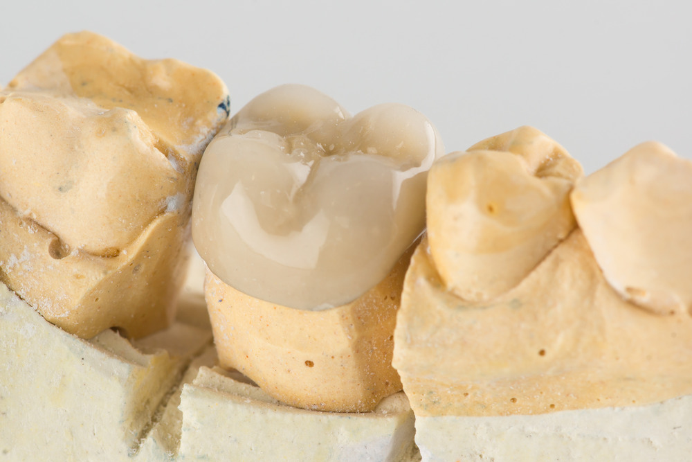 Ceramic Crowns