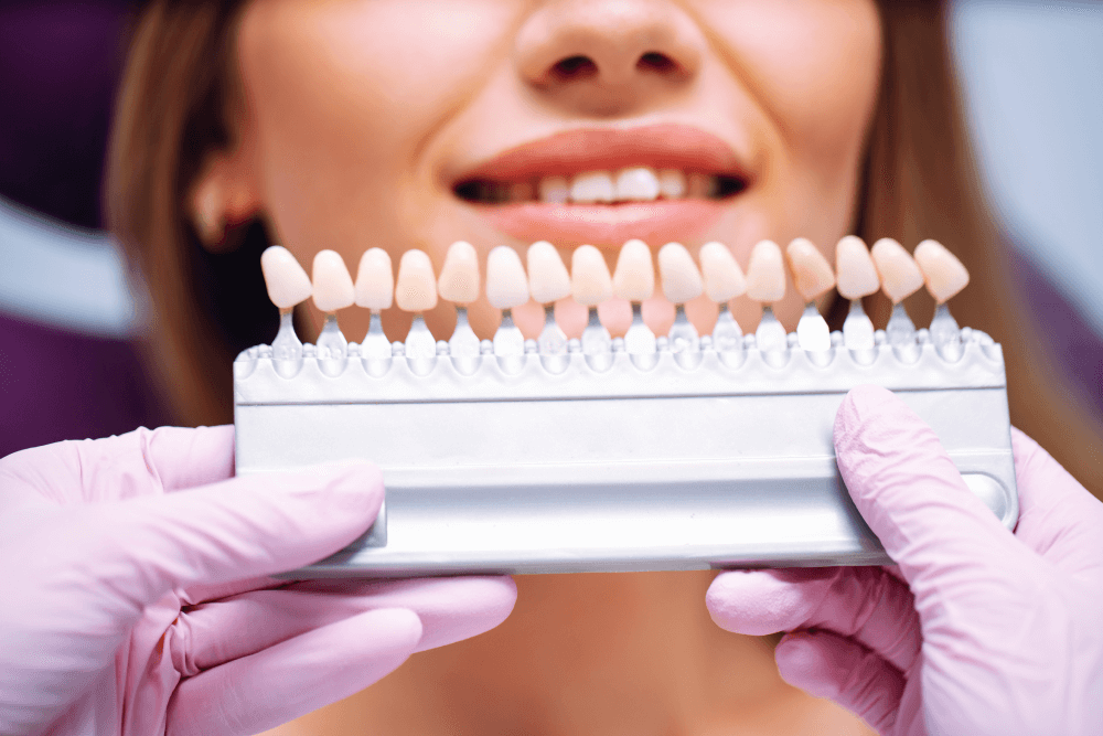 Choosing Between Composite and Porcelain Veneers