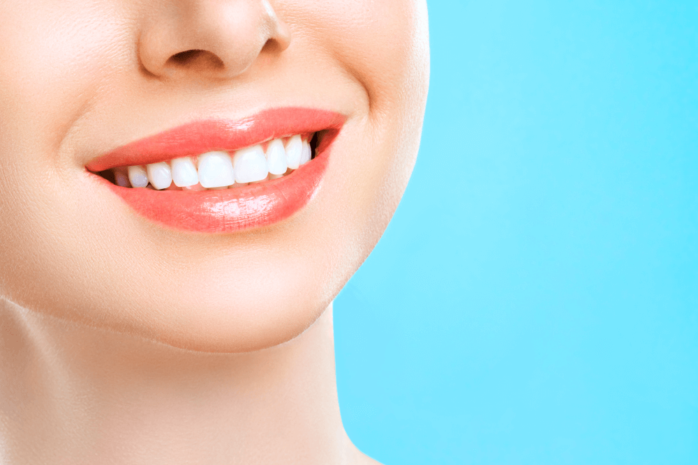 Why Choose Nunyara Dental for Your Veneers