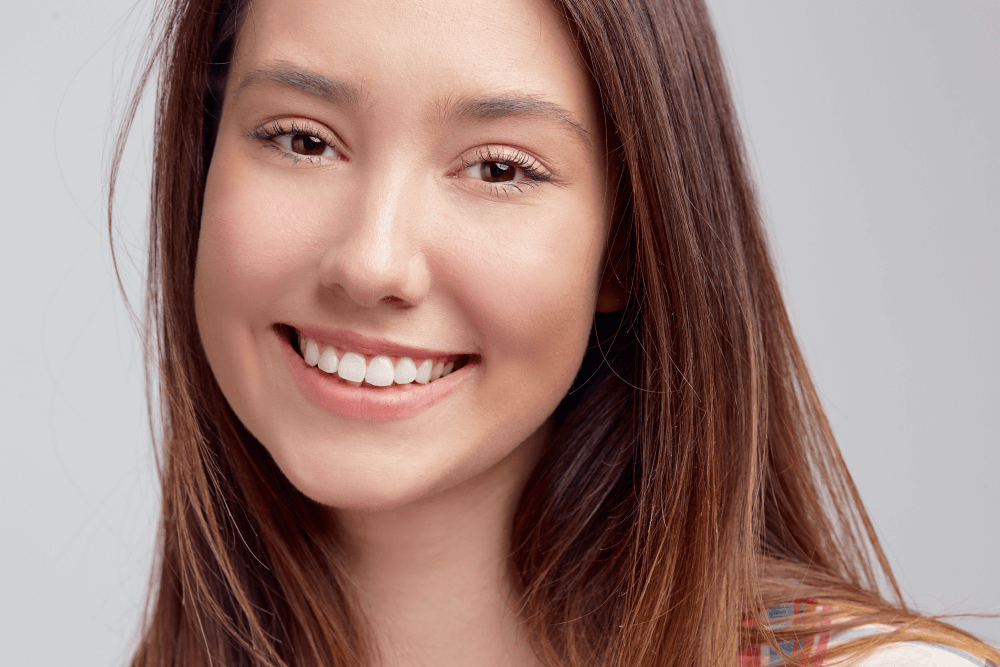 Clear Aligners vs Veneers-Smile Solution