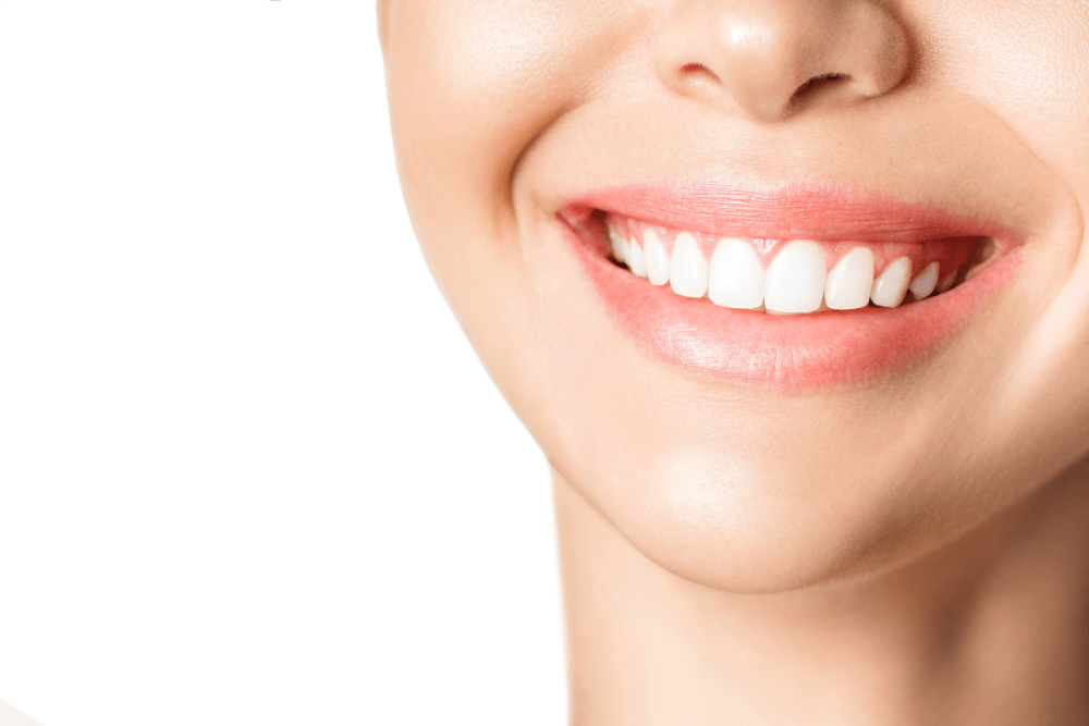 Which Smile Solution Suits