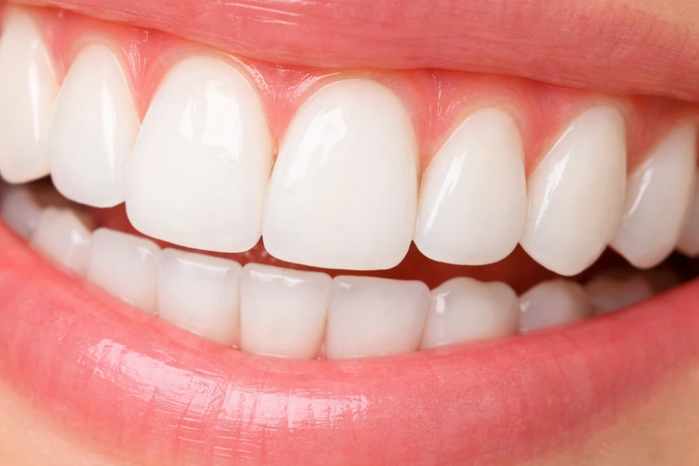 Close up of healthy pink gums - Nunyara Dental Close up of healthy pink gums around aligned straight teeth